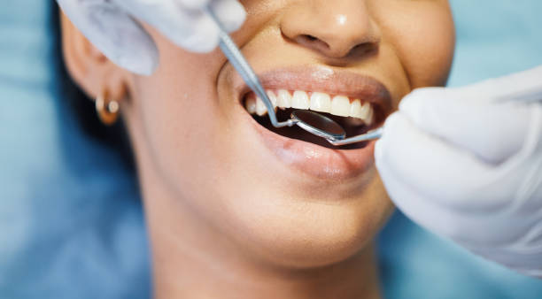 Best Broken or Cracked Tooth Emergency Dentist in Putney, GA